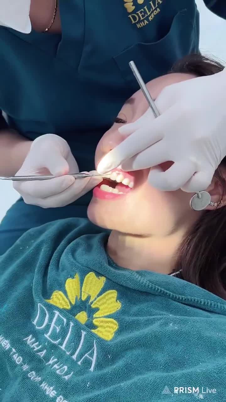 Tư vấn phục hình răng sứ thẩm mỹ cho chị khách hàng đã bọc răng sứ bị hỏng tại cơ sở khác.