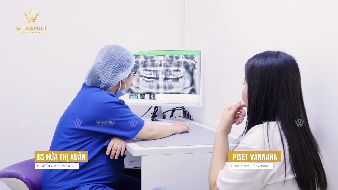 NIỀNG RĂNG 1 HÀM ĐƯỢC ÁP DỤNG CHO TRƯỜNG HỢP NÀO?