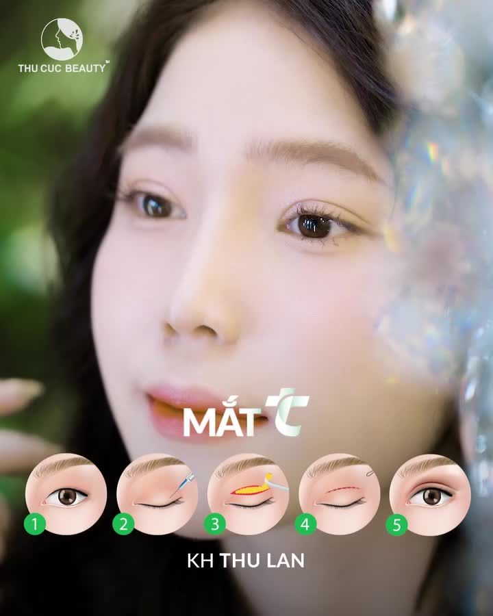 Cơ hội sở hữu 10 suất Mắt TC giá gốc ngay trong tháng 6 này