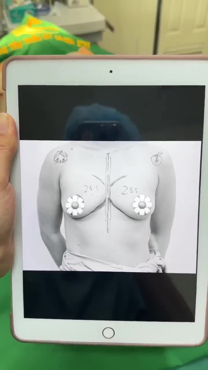 NÂNG CẤP VÒNG 1