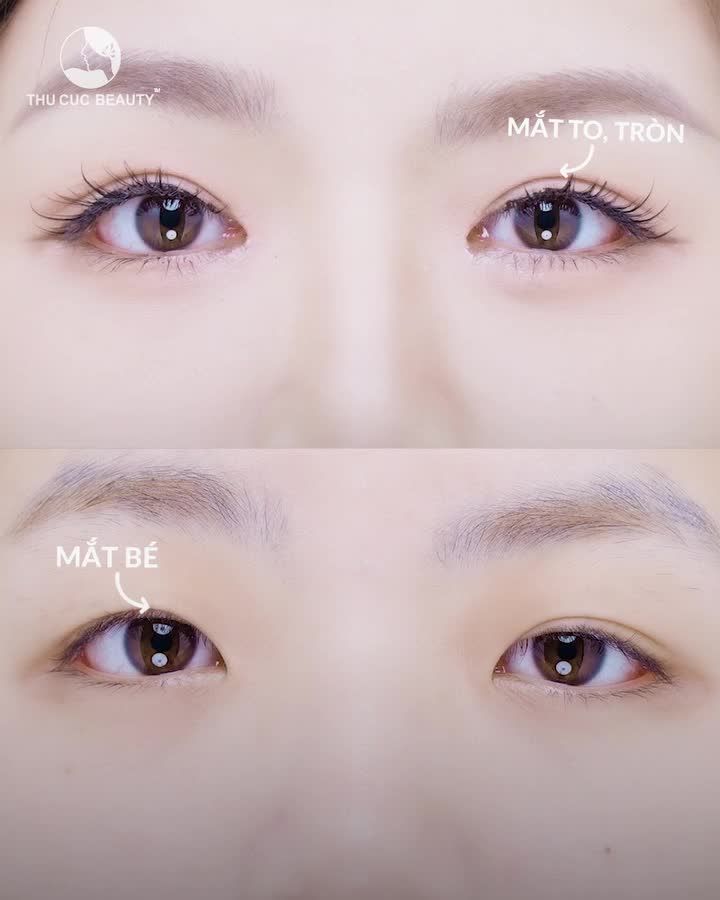 Hè sang Mắt TC ưu đãi lớn -30% duy nhất tháng 6 này