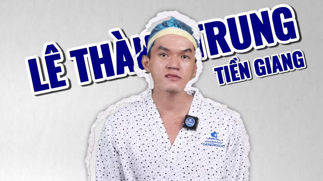 Câu chuyện của anh Trung ở Tiềng Giang chia sẻ khi thực hiện dịch vụ chỉnh hàm dưới tại bệnh viện Gangwhoo.