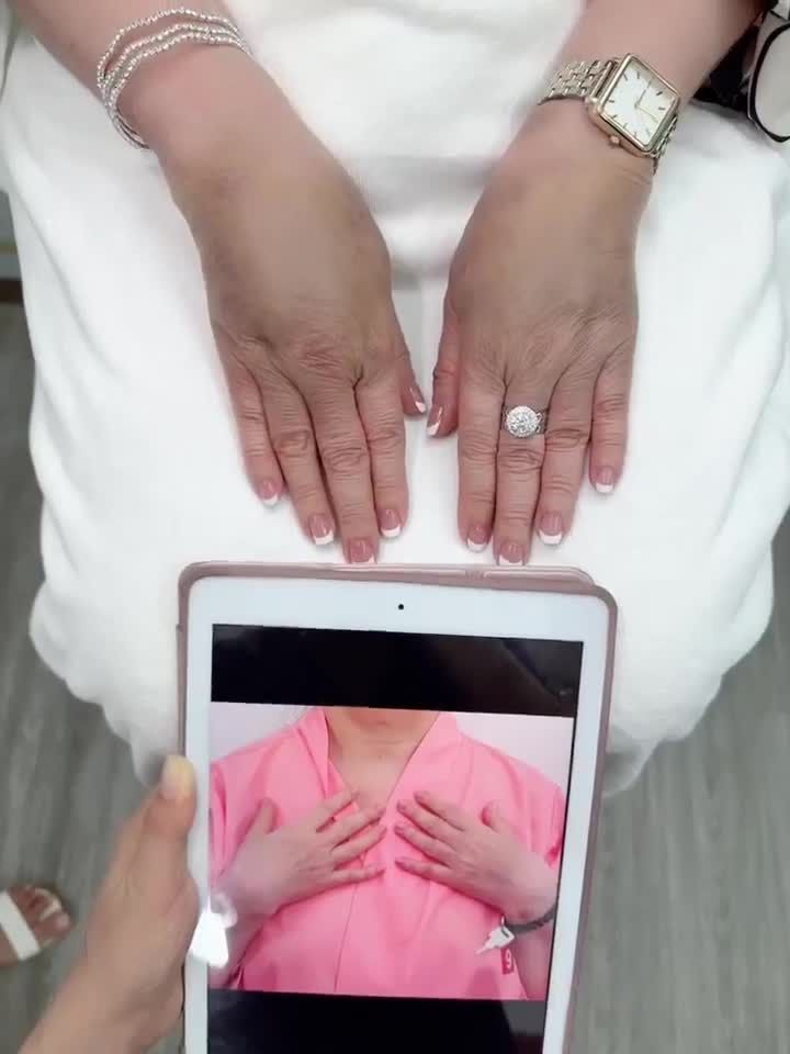 CẤY MỠ MU BÀN TAY - NUỘT NÀ MỀM MẠI SAU 10 NGÀY