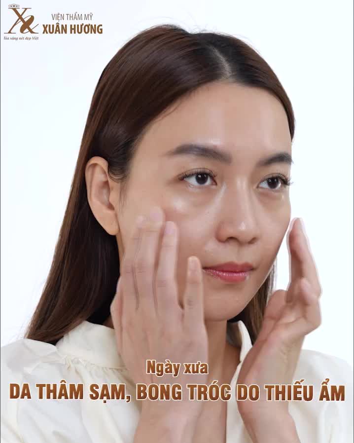 SỞ HỮU VẺ ĐẸP TRONG VEO NHỜ LÀN DA CĂNG BÓNG, MƯỚT MỊN