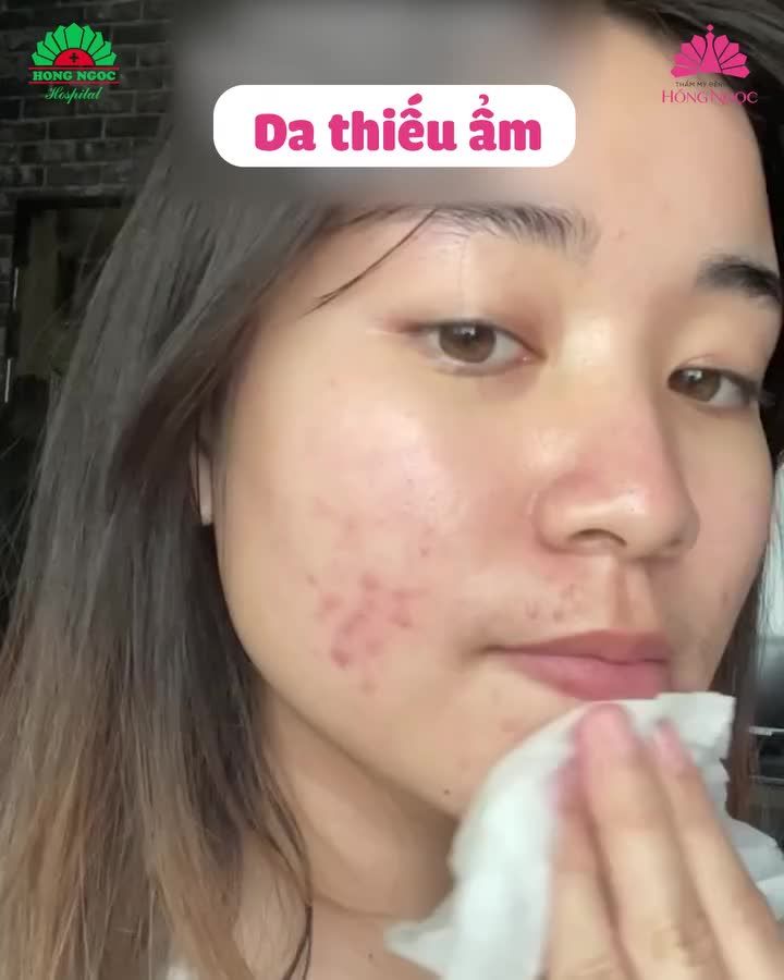 Làn da của bạn đang ra tín hiệu "ét o ét" nếu bạn thấy những tình trạng: