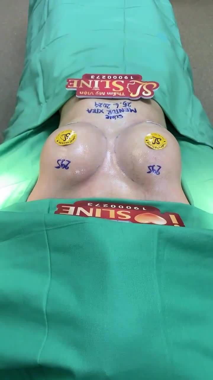 MỀM CĂNG,  SIÊU SEXY TÚI MENTOR XTRA (295- 295CC)