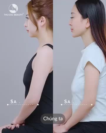 Treo sa trễ sau bao lâu thì được cho con bú?