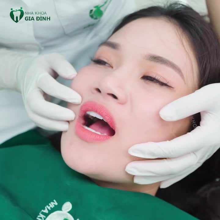 RĂNG SỨ TRẮNG TRONG - KHÔNG GÂY ĐEN VIỀN NƯỚU - ​​​​​​​ĐỘ BỀN CHẮC DÀI LÂU CHỈ CÓ TẠI NHA KHOA GIA ĐÌNH