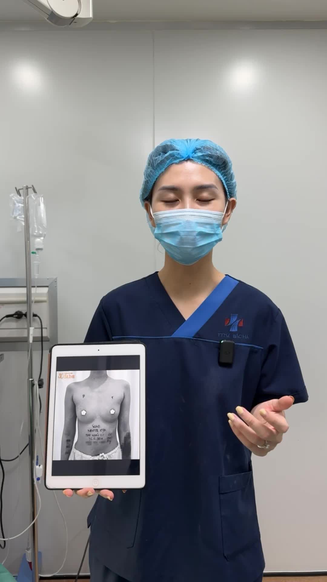 TEO LÉP SAU SINH! ...Tình trạng quá phổ biến của chị em sau sinh.