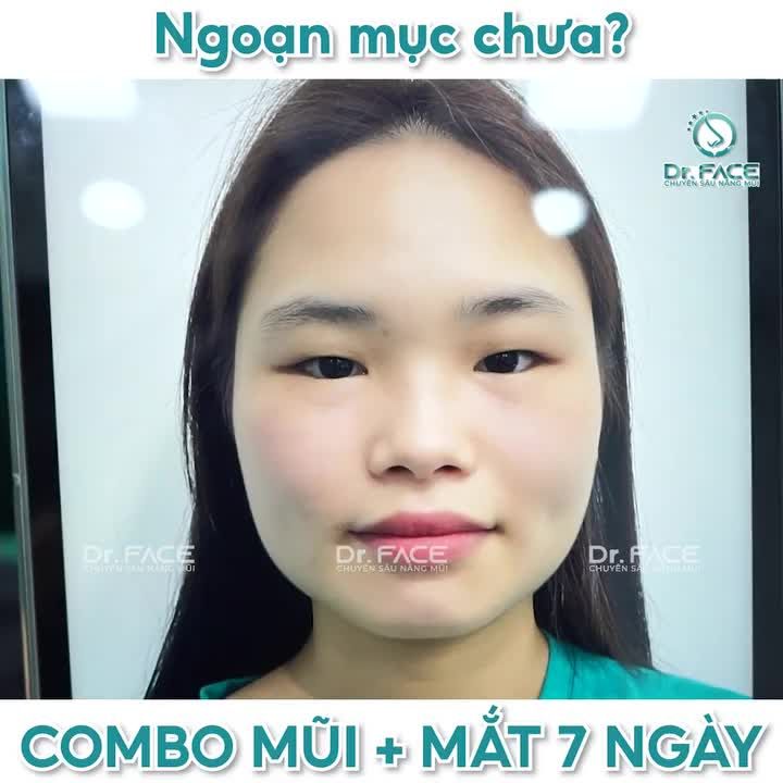 Ngoạn mục chưa? COMBO MŨI + MẮT 7 ngày