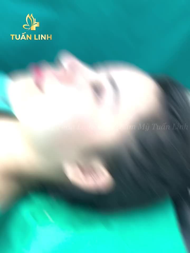 15triệuNanag cấp chiêucs mũi với giá 15tr đẹp xuất sắc sau 60 phút
