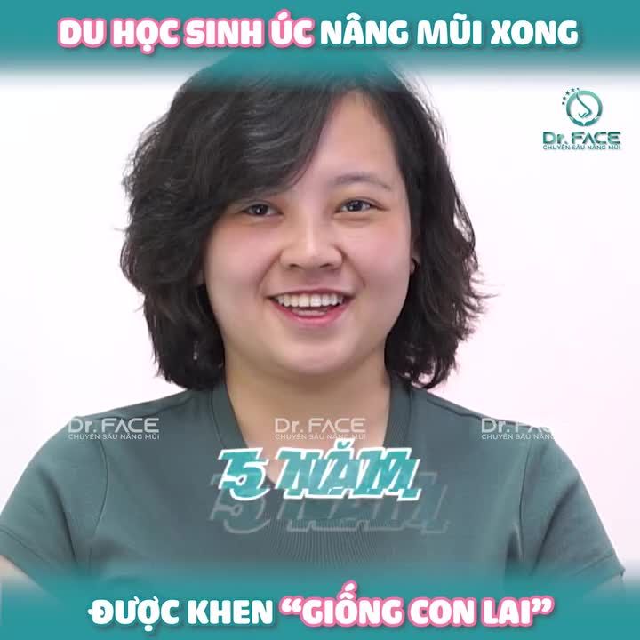 Du học sinh Úc nâng mũi xong được khen “GIỐNG CON LAI”