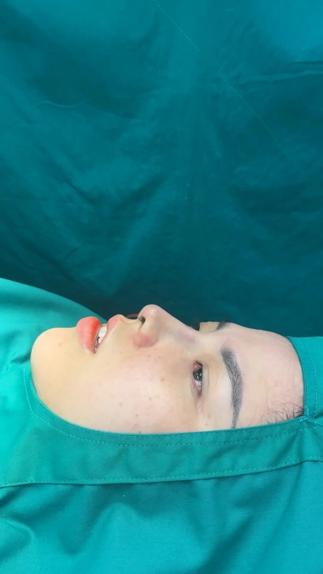 Case mũi cấu trúc vừa hoàn thành