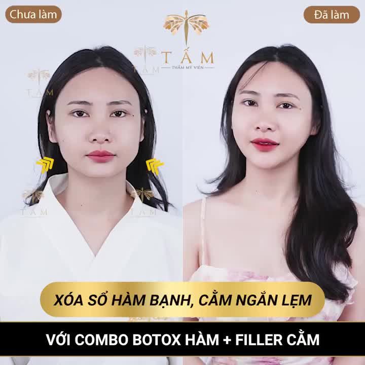 N GÁI GÌ MÀ MẶT THÌ VUÔNG, HÀM CỨ BẠNH RA TRÔNG CHẲNG NỮ TÍNH CHÚT NÀO, EM TỰ TI QUÁ CHỊ ƠI!