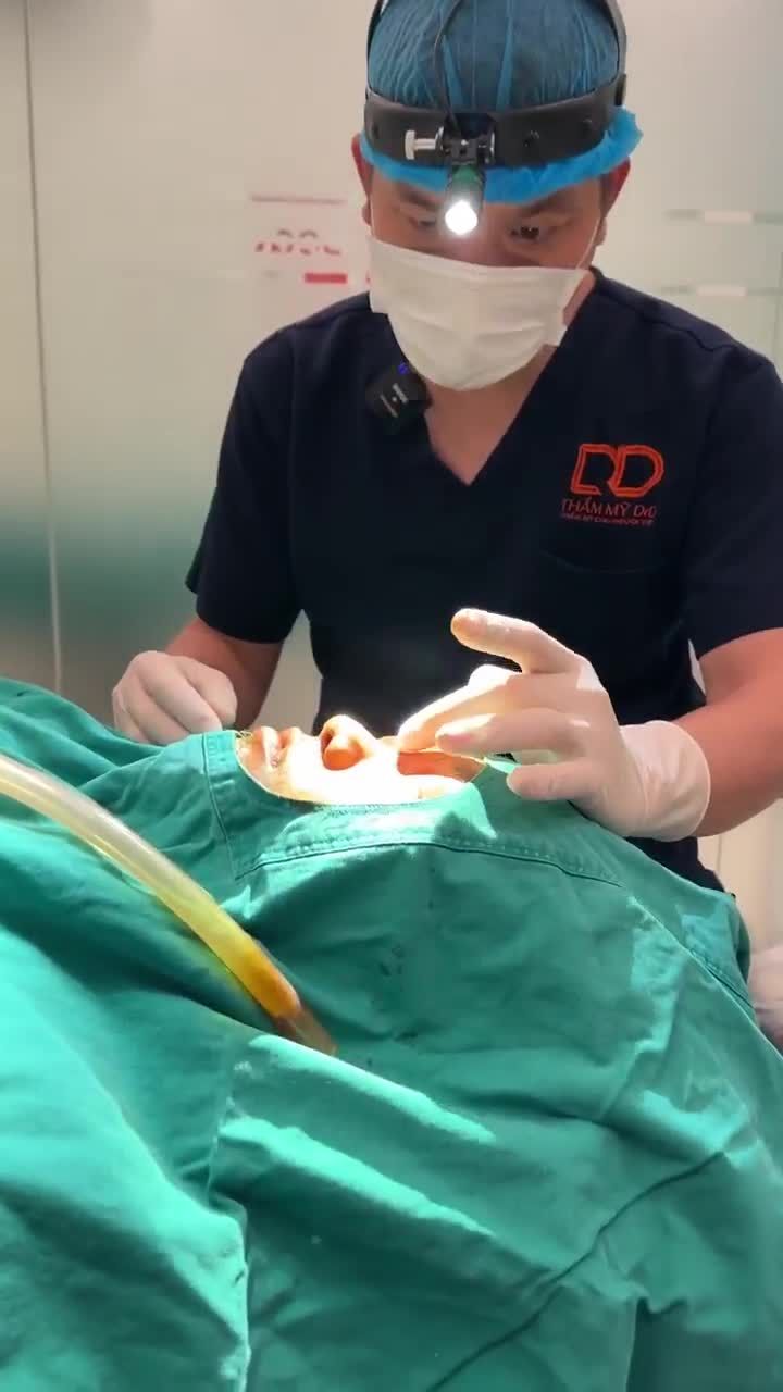 BÁC SĨ LÊ HỮU ĐIỀN PHÂN TÍCH TÌNH TRẠNG MŨI TRƯỚC CỦA BẠN KHÁCH HÀNG!