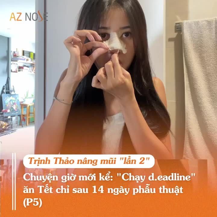 Đoạn kết ngọt ngào của diễn viên Trịnh Thảo sau 2 tháng tái tạo mũi h.ỏng, do bác sĩ CKI. Đinh Xuân Sơn Tùng thực hiện.