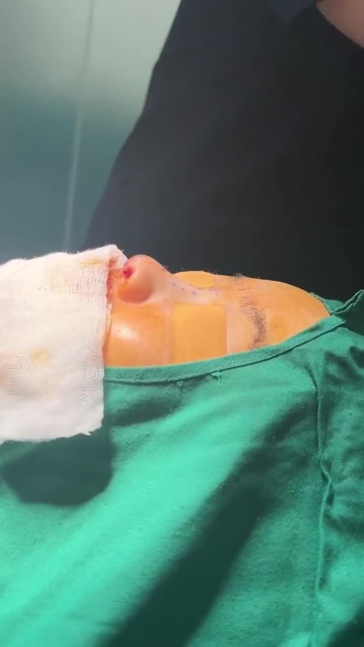BÁC SĨ ĐIỀN PHÂN TÍCH VÀ ĐƯA RA GIẢI PHÁP KHẮC PHỤC TỐI ĐA NHỮNG NHƯỢC ĐIỂM TRÊN MŨI KHÁCH HÀNG.