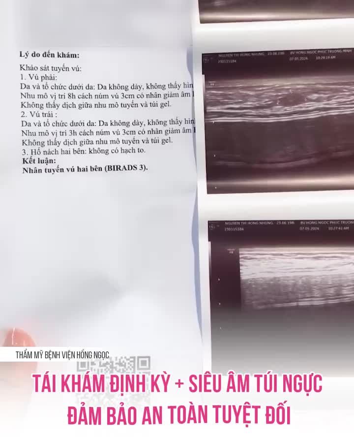 TÁI KHÁM ĐỊNH KỲ SIÊU ÂM TÚI NGỰC ĐẢM BẢO AN TOÀN TUYỆT ĐỐI