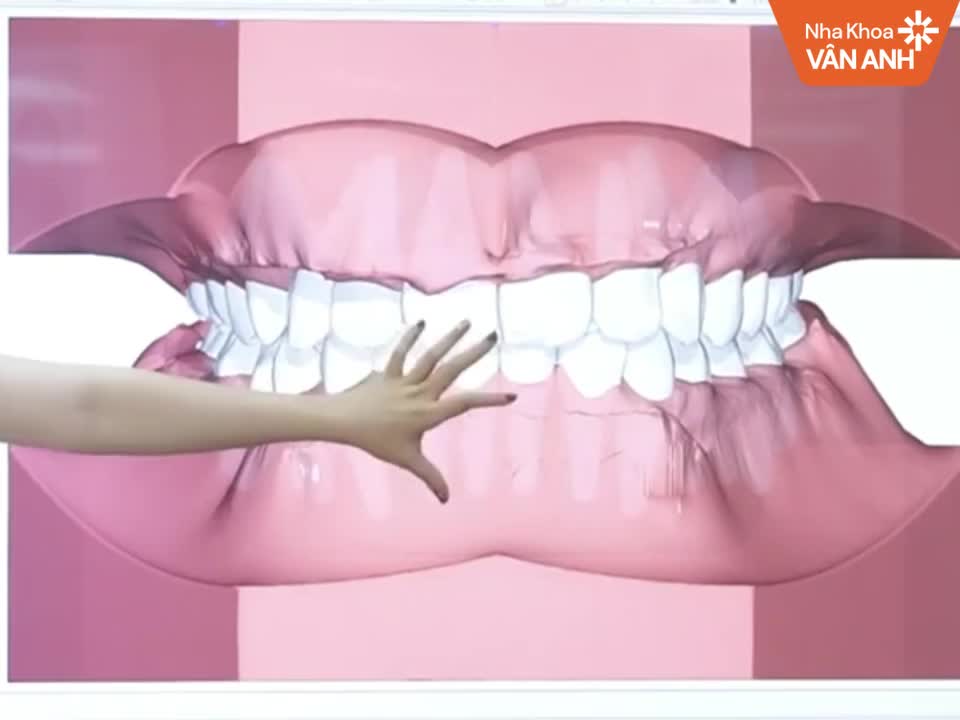 MÁY QUÉT DẤU RĂNG THẾ HỆ MỚI - BƯỚC ĐỘT PHÁ TRONG NHA KHOA
