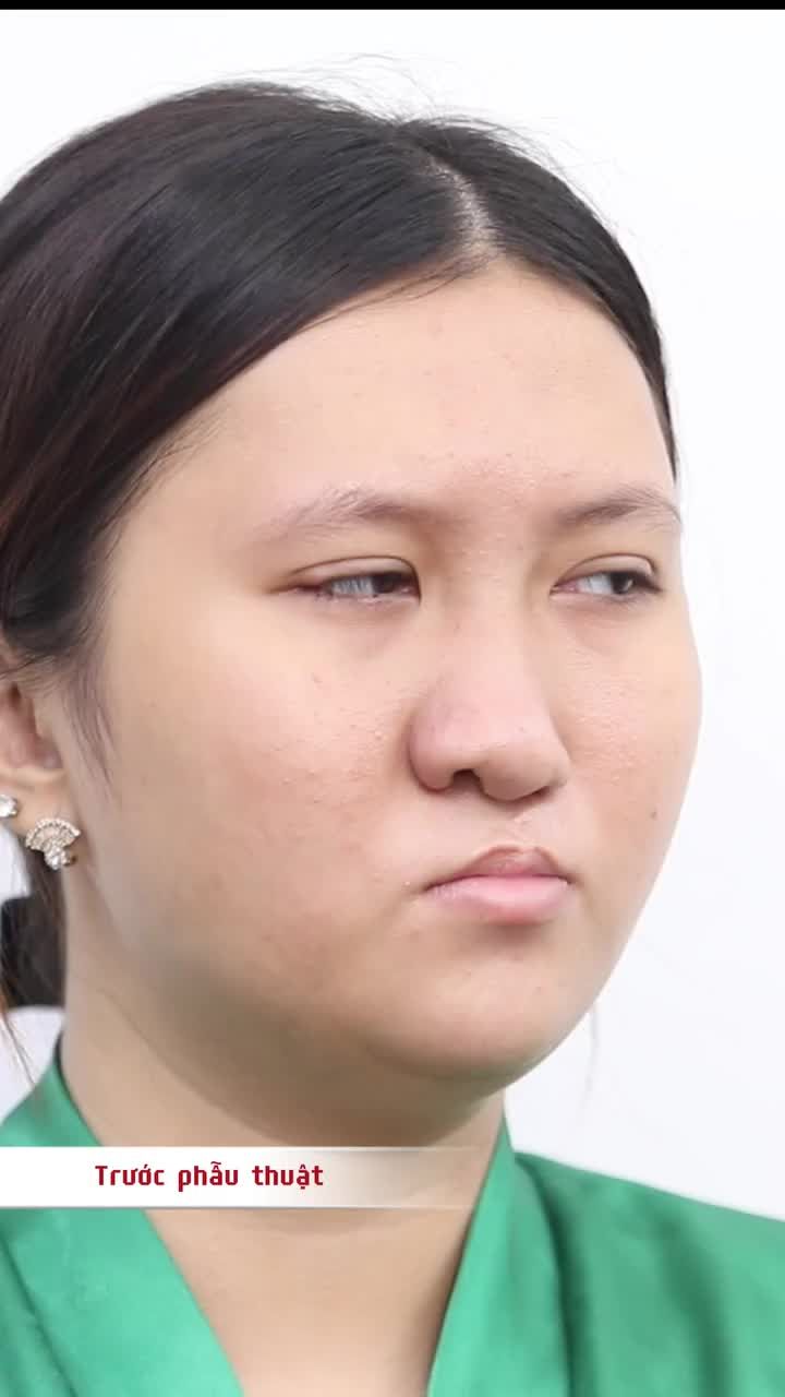 TUYẾT NHUNG - PHẦN 3: ĐỨA TRẺ VỪA MỚI SINH RA ĐÃ BẤT HẠNH
