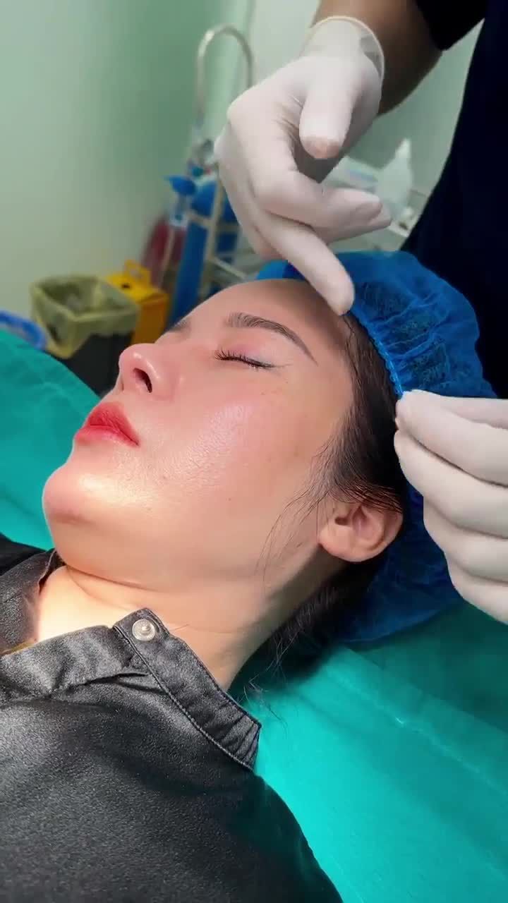 BÁC SĨ CHIA SẺ VỀ TÌNH TRẠNG NẾP NHĂN ĐUÔI MẮT