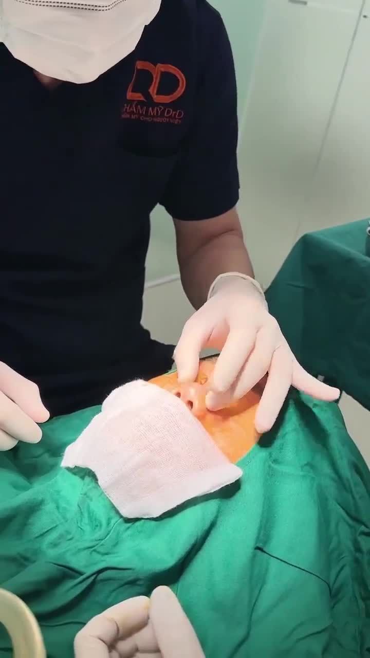 BÁC SĨ ĐIỀN PHÂN TÍCH TÌNH TRẠNG MŨI TRƯỚC CỦA KHÁCH HÀNG