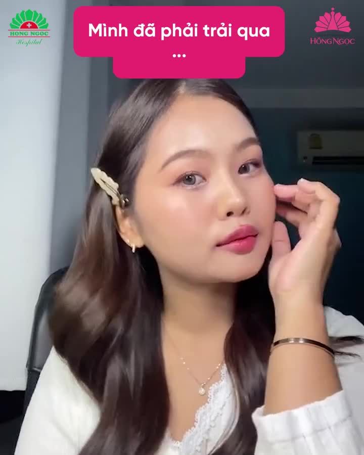 Điển hình một ca lột x.ác thành công nhờ Acne Medic. Rũ bỏ tự ti vì làn da mụn, Hương Trà chia sẻ rằng đã cảm thấy yêu đời và yêu bản thân hơn.