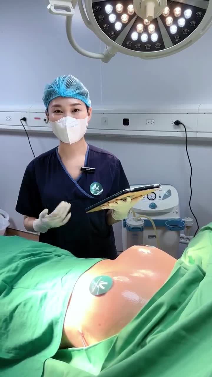 Ca nâng cấp v1 vừa được ekip Dr. Minh Phạm thực hiện