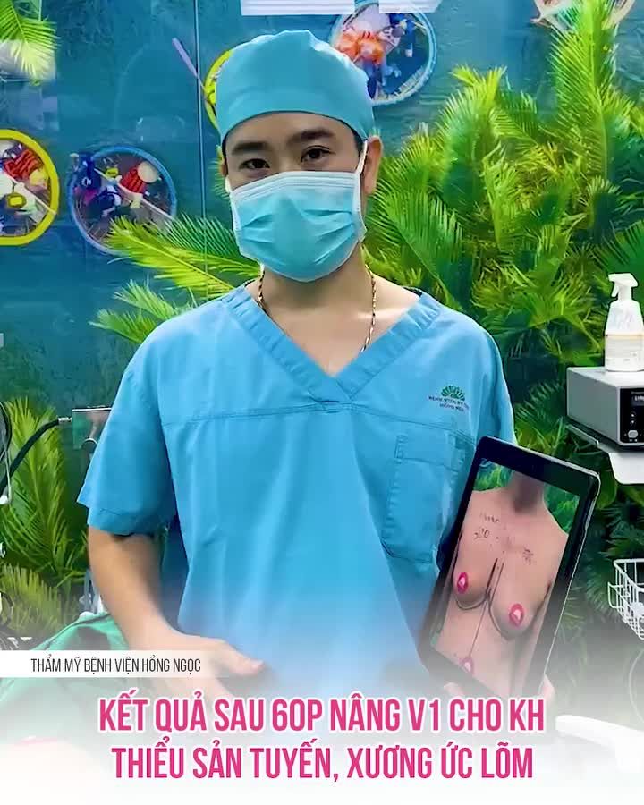 VÒNG 1 HOÀN HẢO SAU NÂNG CẤP 60P