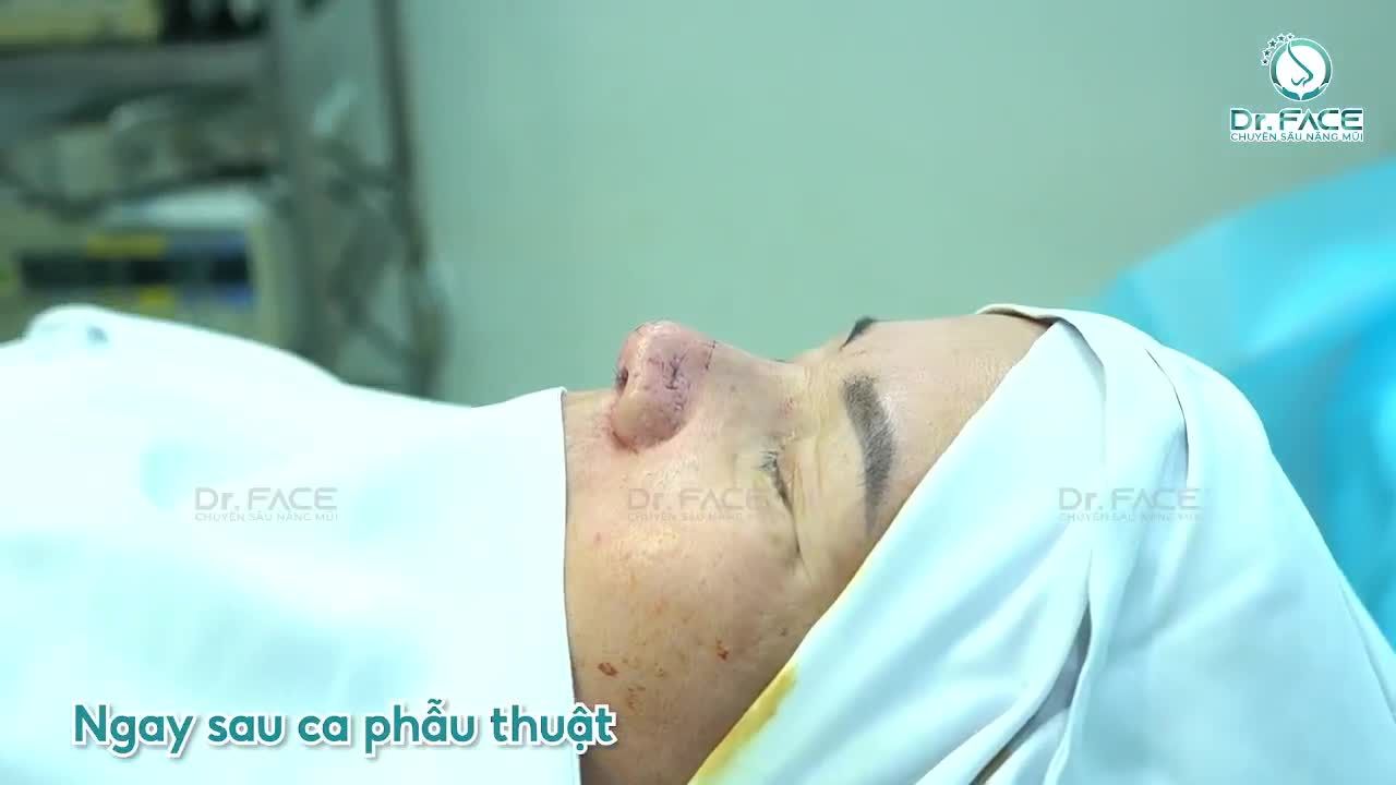 “Mỗi ĐƯỜNG KHÂU là một CHỮ KÝ của mình trên người KH”