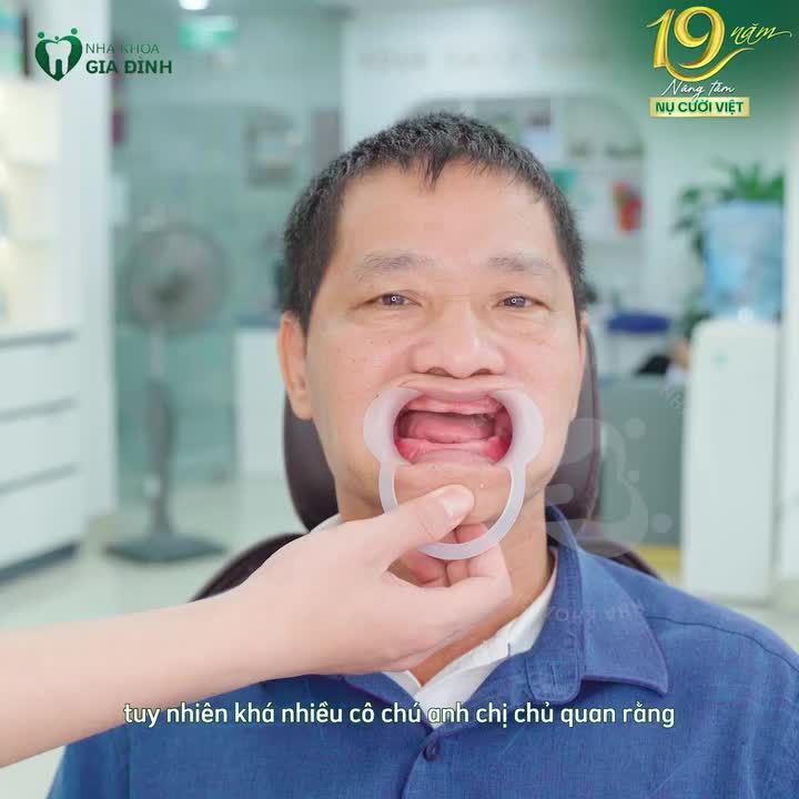 ĐỂ TRỐNG RĂNG LÂU NĂM, GÂY LÃO HÓA SỚM
