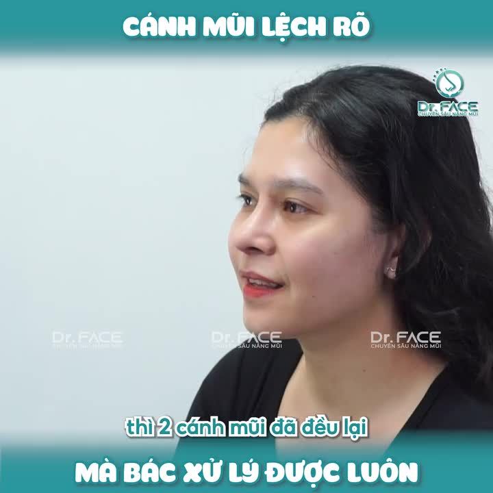 “CÁNH MŨI LỆCH rõ mà bác XỬ LÝ ĐƯỢC luôn”