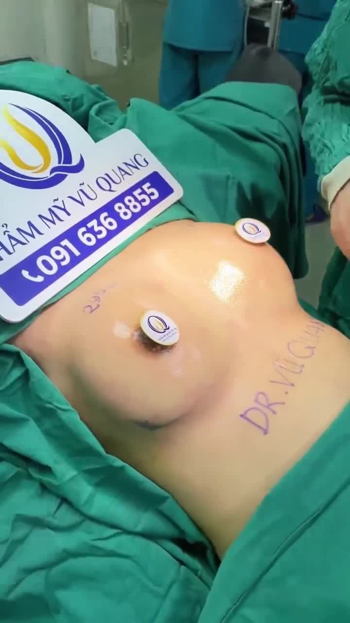 Kết quả nâng cấp vòng 1 cho khách hàng tại Thẩm Mỹ Vũ Quang