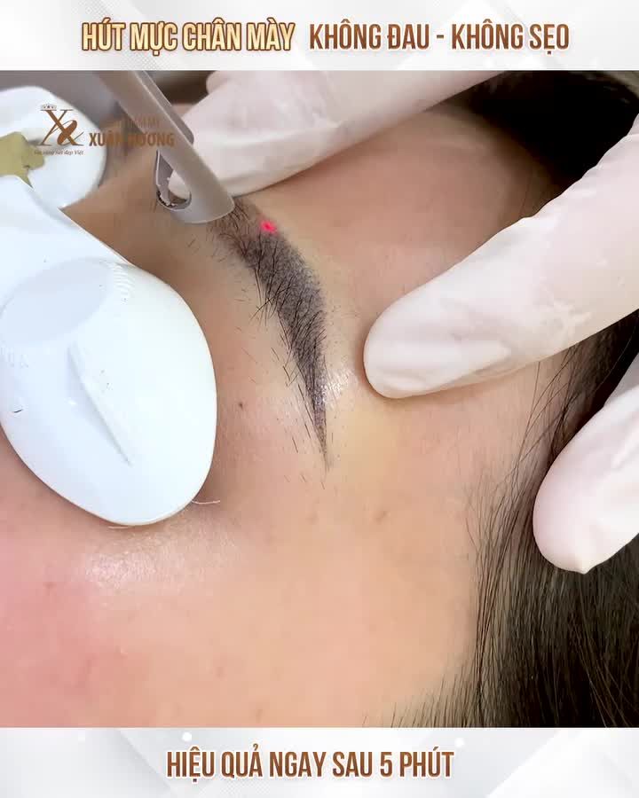 HIỆU QUẢ MỜ NGAY MỰC XĂM LÔNG MÀY CHỈ SAU 5 PHÚT
