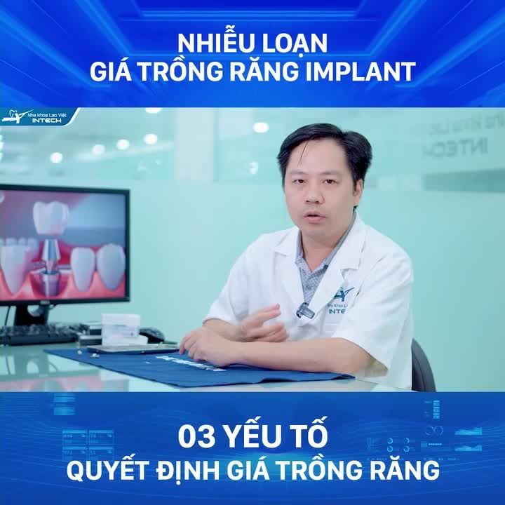 3 YẾU TỐ QUYẾT ĐỊNH GIÁ TRỒNG RĂNG IMPLANT