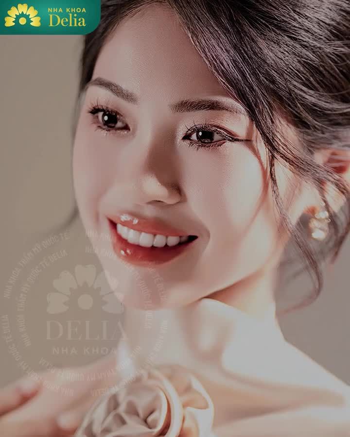 TIN TƯỞNG BẠN BÈ, QUYẾT ĐỊNH LÀM RĂNG SỨ TẠI DELIA ​​​​​​​  KẾT QUẢ SAU 1 NĂM RA SAO?