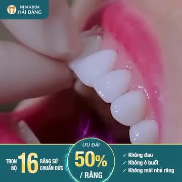 NHA KHOA HẢI ĐĂNG tri ân khách hàng - Trợ giá THẨM MỸ RĂNG SỨ chưa từng có! Giảm 50% cho dòng sứ cao cấp của Đức.