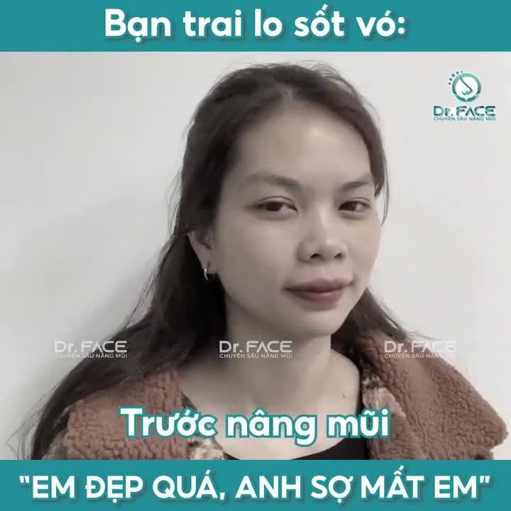 Bạn trai lo sốt vó: “EM ĐẸP QUÁ, ANH SỢ MẤT EM”