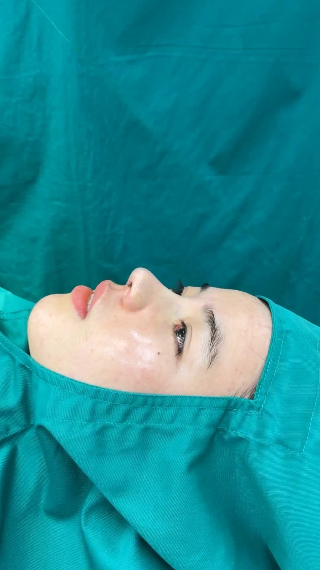 Case mũi cấu trúc vừa hoàn thành