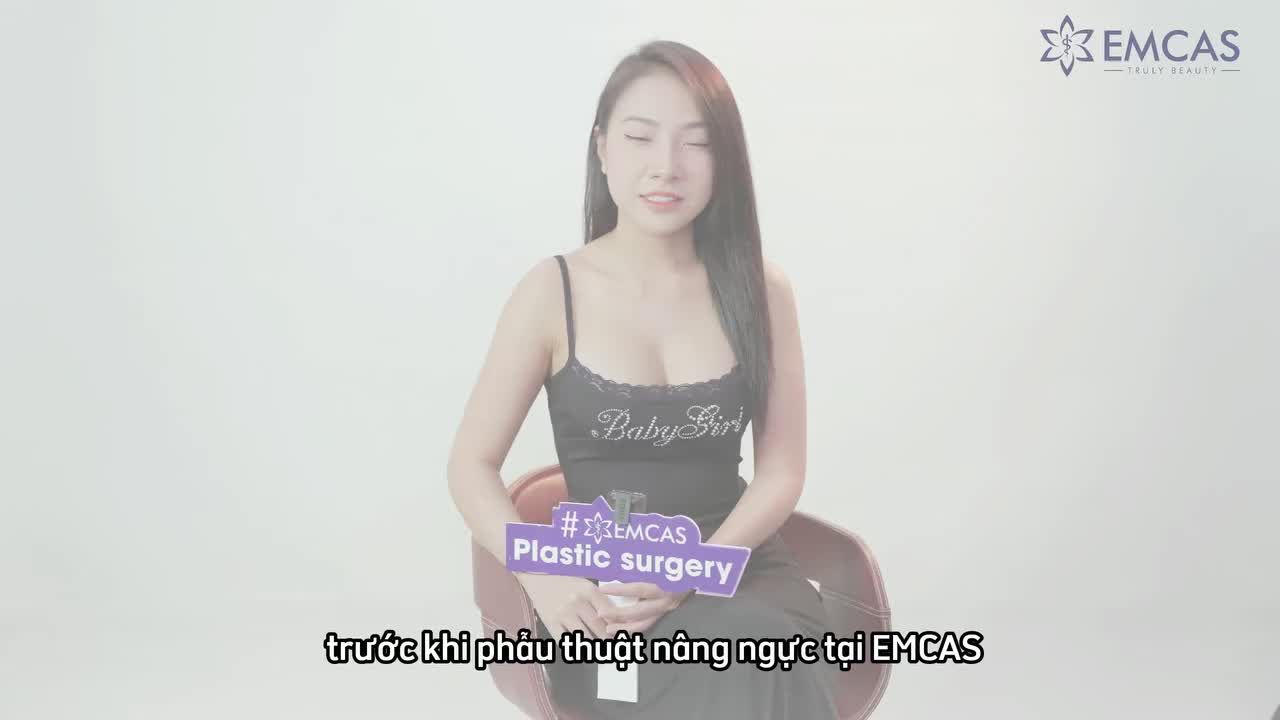 Quy trình Nâng vòng 1 tại EMCAS đạt chuẩn y khoa: