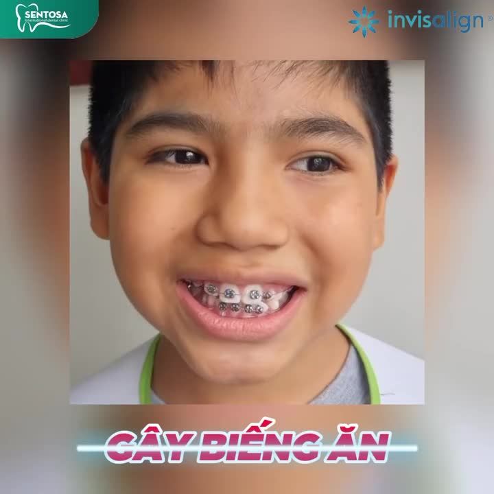 TUỔI TEEN NĂNG ĐỘNG, NHIỆT HUYẾT NHƯNG VẪN VÔ TƯ NIỀNG RĂNG