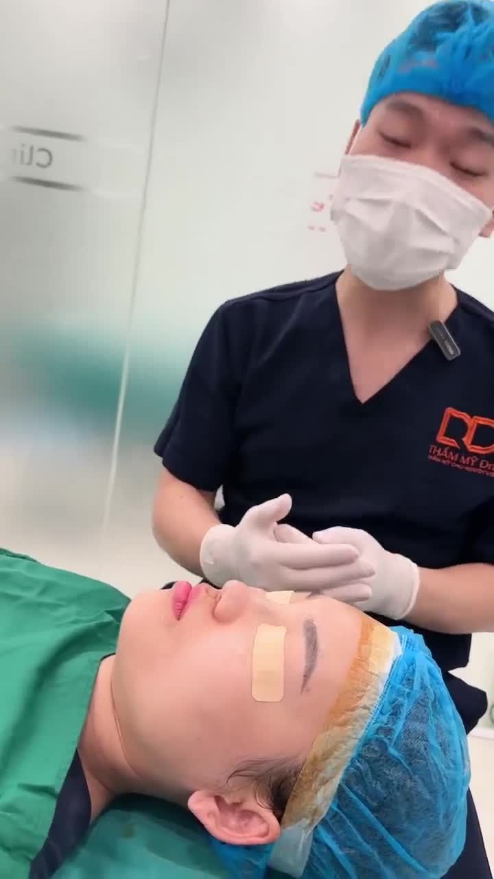 KẾT QUẢ CA PHẪU THUẬT NÂNG MŨI SLINE