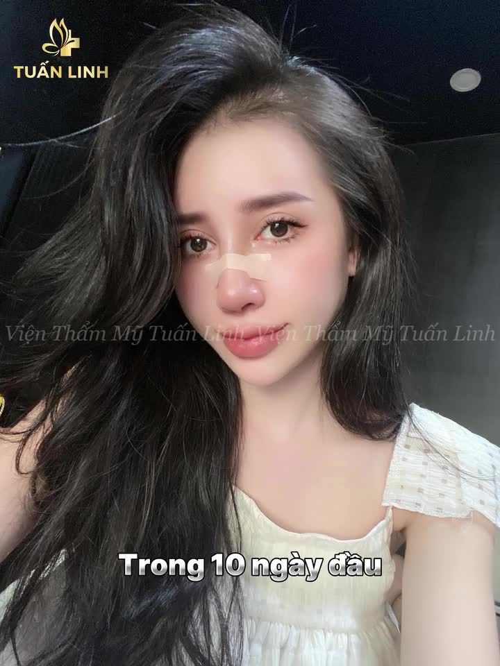 Chiếc mũi cao xinh sẽ thay đổi gương mặt bạn như thế nào?