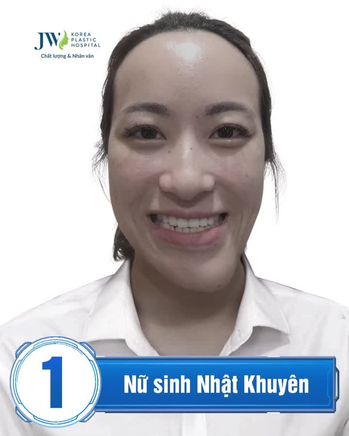 GIẬT MÌNH trước NHAN SẮC của Top 5 NAM THANH NỮ TÚ sau Phẫu thuật hàm hô, móm tại JW TIẾT KIỆM 13.5 Triệu thay đổi gương mặt, đặt lịch ngay: https://m.me/benhvienjw.vn