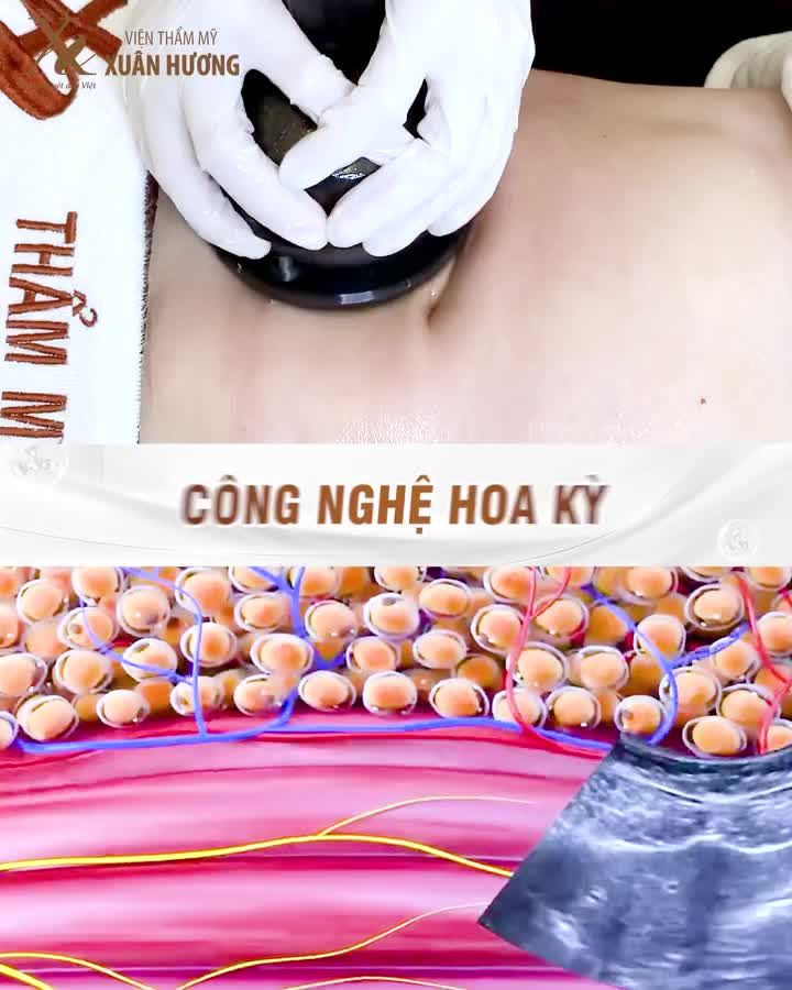 SIẾT 15CM VÙNG EO TỰ TIN KHOE DÁNG CÙNG DETOX SLINE BODY