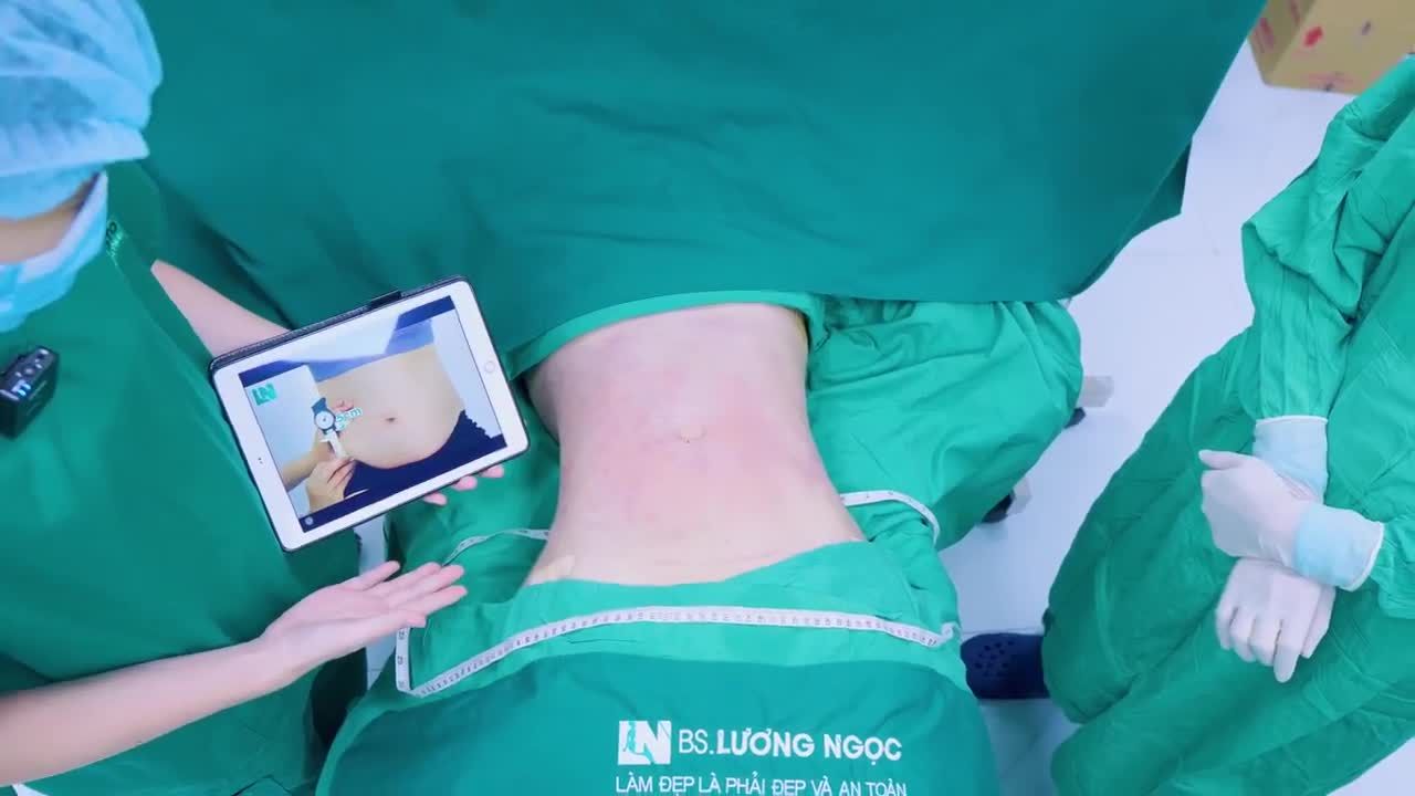 Không còn sồ sề, ngấn mỡ, chị S giờ đây đã lấy lại đường cong body quyến rũ chỉ sau 60 phút thực hiện hút mỡ tạo dáng.