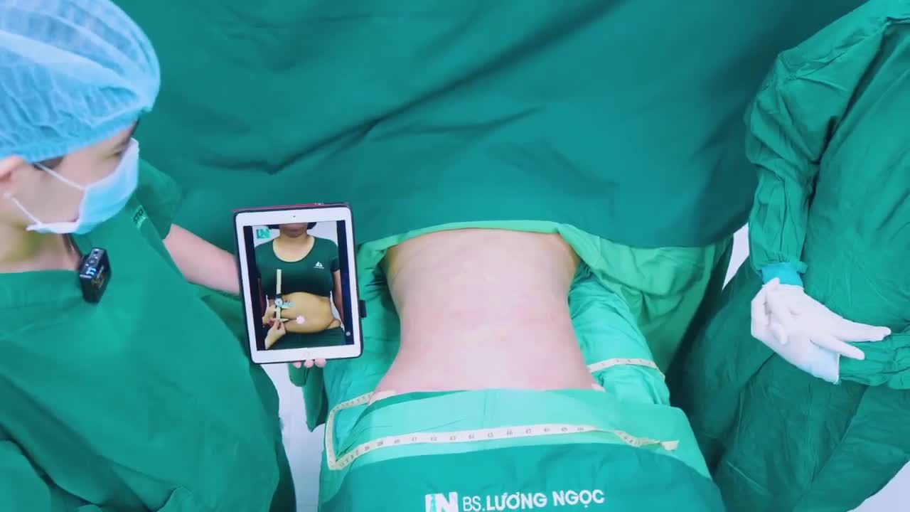 CỨU “BỤNG HỎNG” ĐÃ TỪNG CẮT DA NHƯNG CHƯA HẾT MỠ!