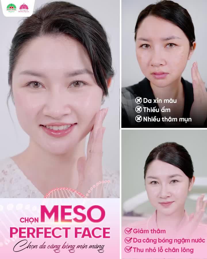 TIẾT LỘ BÍ KÍP DA CĂNG BÓNG ĐÓN HÈ NHỜ MESO PERFECT FACE