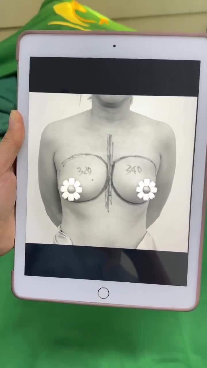 NÂNG NGỰC KHÔNG CHẠM