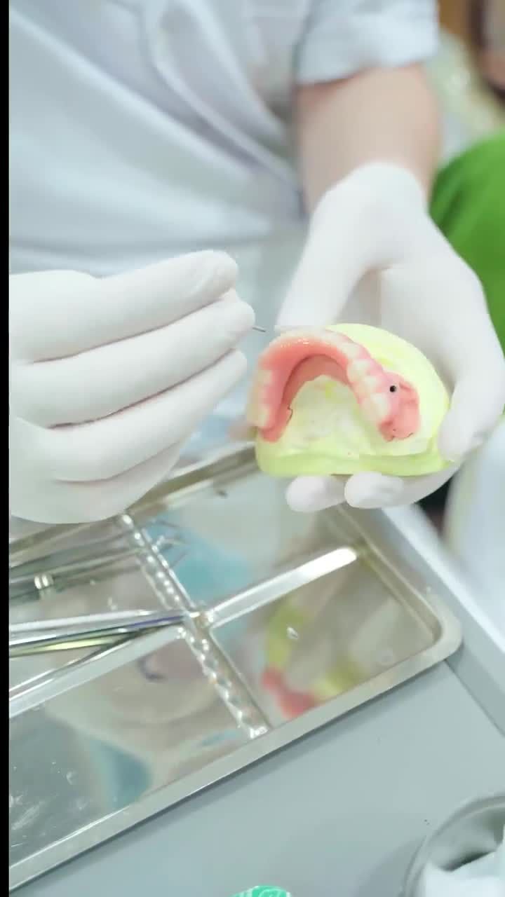 QUÁ TRÌNH BÁC SĨ HẢI THỰC HIỆN LẮP CỐ ĐỊNH RĂNG TOÀN HÀM TRÊN IMPLANT CHO CÔ KHÁCH HÀNG